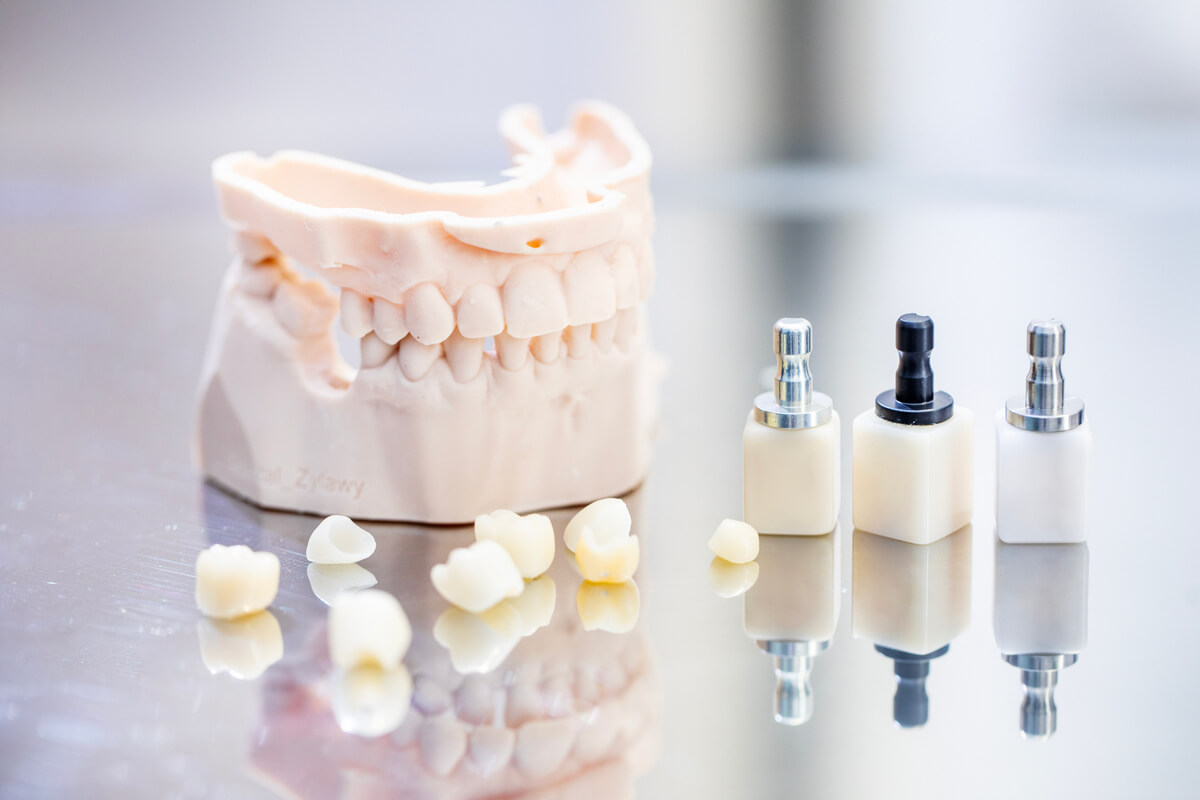 Korony i mosty na tlenku cyrkonu