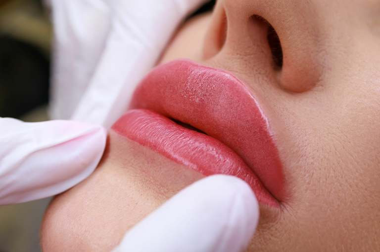 Modelowanie i powiększanie ust Modelowanie i powiększanie ust – Adental Wrocław, Jelcz-Laskowice