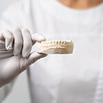 Dlaczego implant może się nie przyjąć i jak temu zapobiec